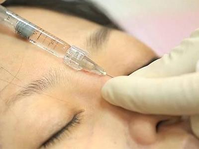 玻尿酸最全的作用和危害,玻尿酸保濕抗老還你好皮膚