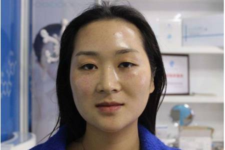 玻尿酸原液的作用和使用方法，女性天天用玻尿酸的后果