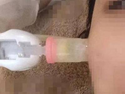 微針和水光針有什么區(qū)別?哪個(gè)治療效果會(huì)更好