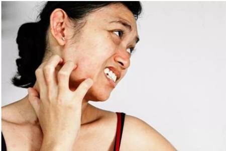 臉過敏發紅癢怎么辦，緊急護膚方法保濕消紅腫