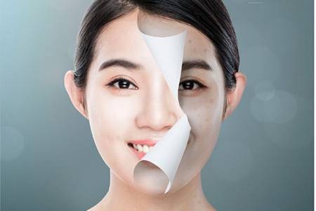 女生油性皮膚怎么改善,防曬才是最重要的控油方法-易網<a href=http://www.jsjjzhkt.cn/ target=_blank class=infotextkey>健康養生</a>網 女生油性皮膚怎么改善,防曬才是最重要的控油方法