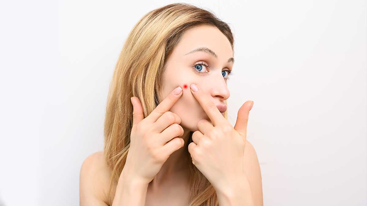 臉上長痘痘要忌口哪些食物 長痘的飲食禁忌