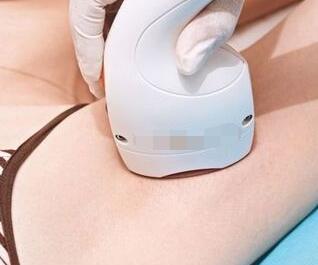 激光脫毛有用嗎?激光脫毛是永久性的嗎?-易網健康<a href=http://www.jsjjzhkt.cn/jkys/ target=_blank class=infotextkey>養生</a>網 激光脫毛有用嗎?激光脫毛是永久性的嗎?