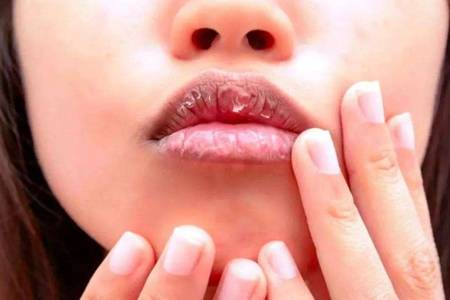 嘴唇干裂脫皮怎么辦,六個潤唇方法養護嬌嫩嘴唇-易網健康<a href=http://www.jsjjzhkt.cn/jkys/ target=_blank class=infotextkey>養生</a>網 嘴唇干裂脫皮怎么辦,六個潤唇方法養護嬌嫩嘴唇