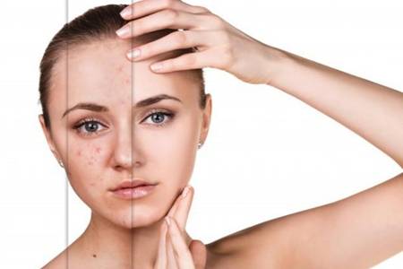 女生額頭長痘痘是什么原因,一按就痛要怎么調理-易網<a href=http://www.jsjjzhkt.cn/ target=_blank class=infotextkey>健康養生</a>網 女生額頭長痘痘是什么原因,一按就痛要怎么調理