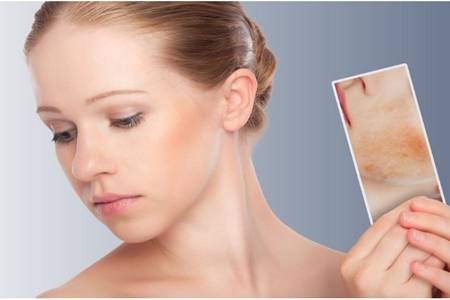 皮膚過敏癥狀有哪些,女性皮膚初期過敏如何治療-易網健康<a href=http://www.jsjjzhkt.cn/jkys/ target=_blank class=infotextkey>養生</a>網 皮膚過敏癥狀有哪些,女性皮膚初期過敏如何治療