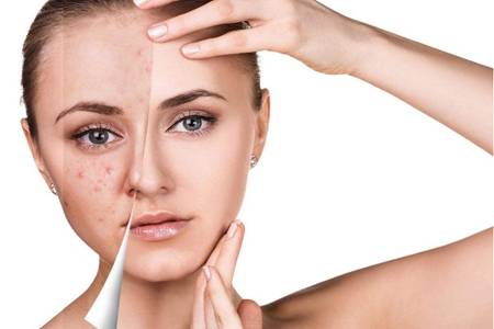 鼻子上長痘痘的原因，減少鼻頭長痘少做這三件事