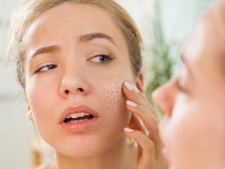 中性皮膚有什么特征？中性皮膚怎么保養比較好？