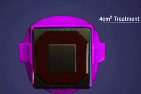 眼部有細(xì)紋做1次熱瑪吉 勝過8000斤雅詩蘭黛眼霜