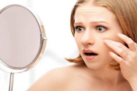 臉上長痘痘如何消除用什么藥 這3個(gè)最簡單的祛痘方法要記住