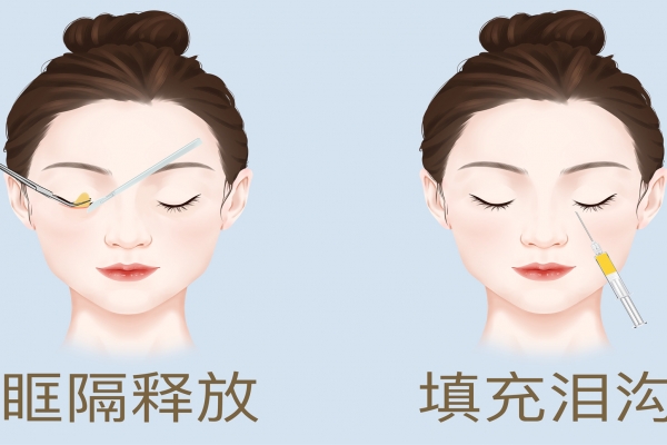 整容都包括哪些項目-易網<a href=http://www.jsjjzhkt.cn/ target=_blank class=infotextkey>健康養生</a>網 整容都包括哪些項目