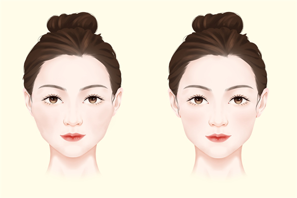 打瘦臉針的注意事項-易網(wǎng)<a href=http://www.jsjjzhkt.cn/ target=_blank class=infotextkey>健康養(yǎng)生</a>網(wǎng) 打瘦臉針的注意事項