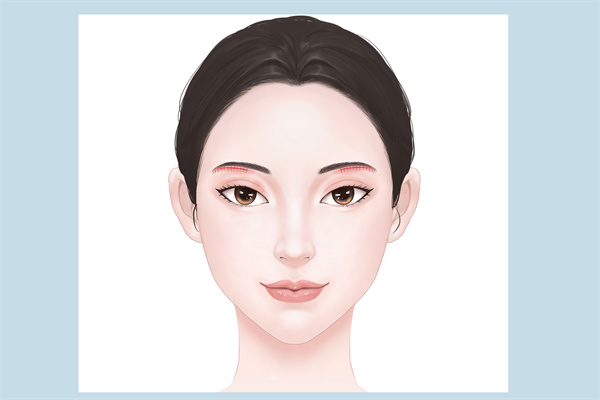 毛孔粗大如何治療?-易網<a href=http://www.jsjjzhkt.cn/ target=_blank class=infotextkey>健康養生</a>網 毛孔粗大如何治療?