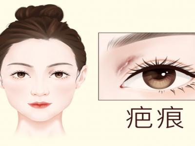 疤痕皮膚修復方法