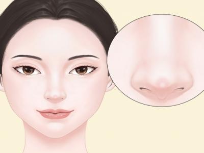 什么是骨粉隆鼻