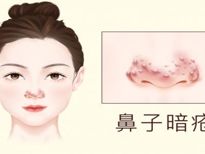 臉色暗沉發黑怎么才能變白