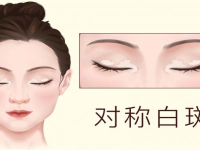 皮膚白斑