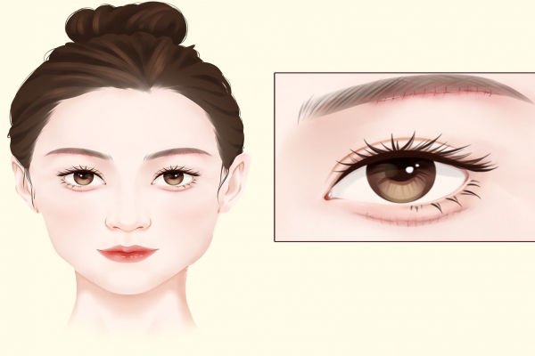 眼袋怎么消除簡單方法-易網<a href=http://www.jsjjzhkt.cn/ target=_blank class=infotextkey>健康養生</a>網 眼袋怎么消除簡單方法