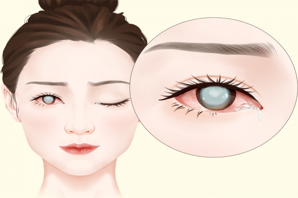 眼部抗衰老的幾個方法-易網健康養生網 眼部抗衰老的幾個方法