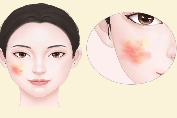 怎樣保養皮膚-易網健康養生網 怎樣保養皮膚