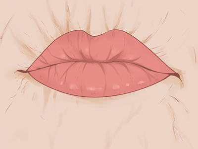 嘴唇整容費用是多少