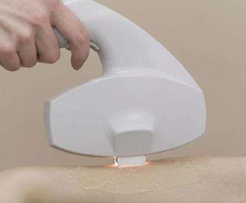 夏季脫毛什么方法好 五方法甩掉“毛手毛腳” 夏季脫毛什么方法好 五方法甩掉“毛手毛腳”