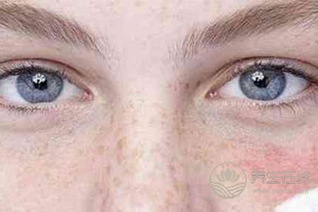 春天預防過敏的方法有哪些? 春天預防過敏的方法有哪些?