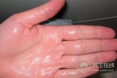 夏季手腳出汗該吃什么食物? 夏季手腳出汗該吃什么食物?