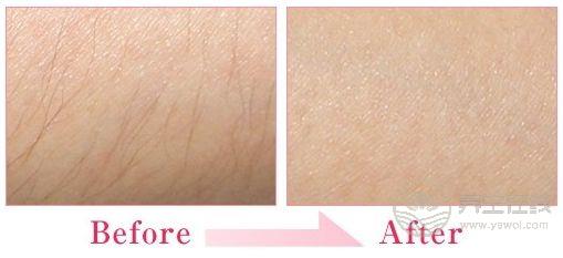 夏季脫毛什么方法好 五方法甩掉“毛手毛腳” 夏季脫毛什么方法好 五方法甩掉“毛手毛腳”