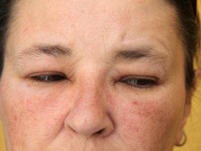 春季過敏,外出踏青要注意哪些問題?