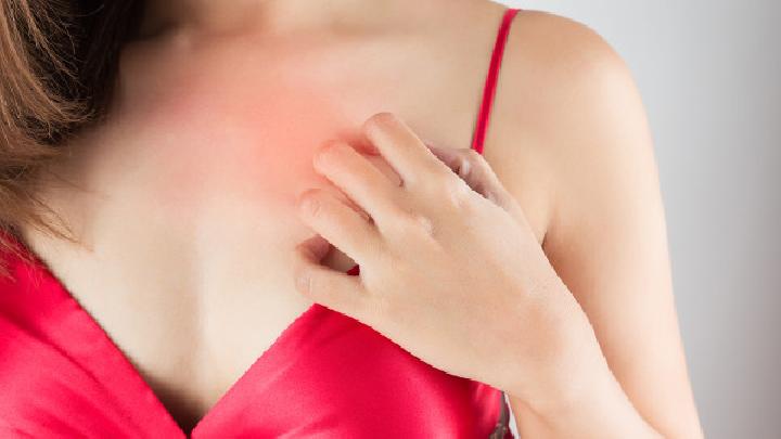 怎么調(diào)理花粉過敏體質(zhì) 花粉過敏主要有三種表現(xiàn)