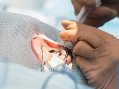 春季鼻炎患者要注意什么事項 鼻炎患者需格外注意這些事項