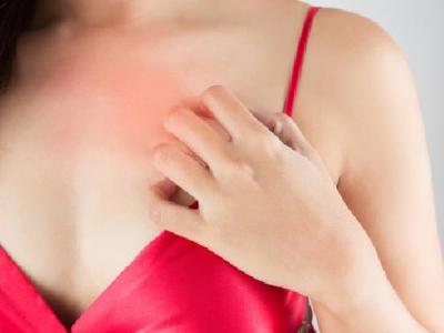 怎么調(diào)理花粉過(guò)敏體質(zhì) 花粉過(guò)敏主要有三種表現(xiàn)