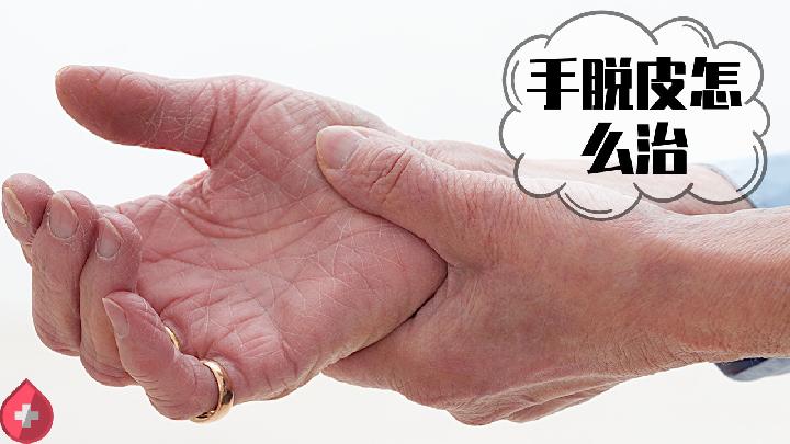 冬天手上皮膚發(fā)黑?5種原因要了解-易網(wǎng)健康<a href=http://www.jsjjzhkt.cn/jkys/ target=_blank class=infotextkey>養(yǎng)生</a>網(wǎng) 冬天手上皮膚發(fā)黑?5種原因要了解