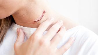 冬天手心出汗?6個情況要知曉-易網健康<a href=http://www.jsjjzhkt.cn/jkys/ target=_blank class=infotextkey>養生</a>網 冬天手心出汗?6個情況要知曉