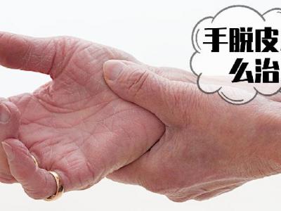 冬天手上皮膚發黑？5種原因要了解