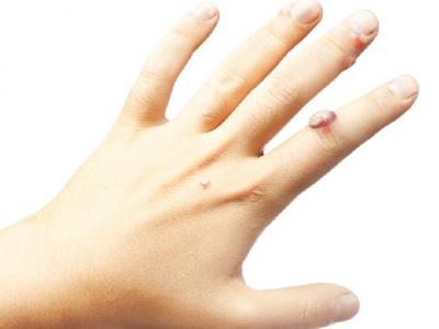 夏季怎么保養(yǎng)皮膚？夏天保護皮膚的方法有什么