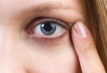 秋季眼睛干澀 按摩術一分鐘幫你搞定