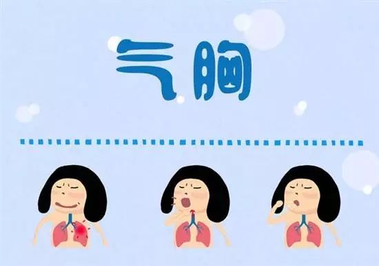 20個生活中的急救常識 20個生活中的急救常識