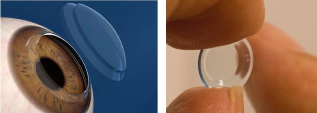 不想讓孩子戴眼鏡,怎么辦? 不想讓孩子戴眼鏡,怎么辦?