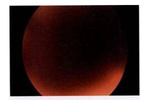 視力快速下降的原因有這么多,你知道嗎? 視力快速下降的原因有這么多,你知道嗎?