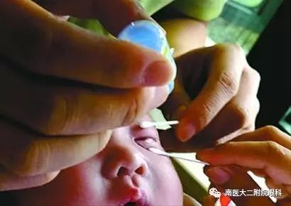 頻繁眨眼,小心是眼病信號 頻繁眨眼,小心是眼病信號