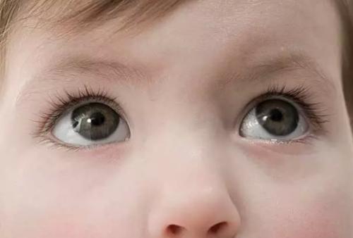 干眼癥是眼病嗎？可以治療嗎？