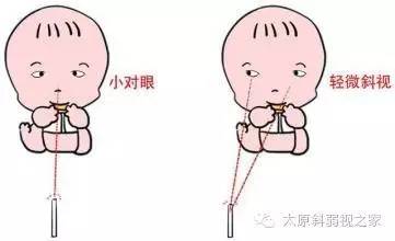 寶寶的視力發(fā)育過(guò)程及檢查方法