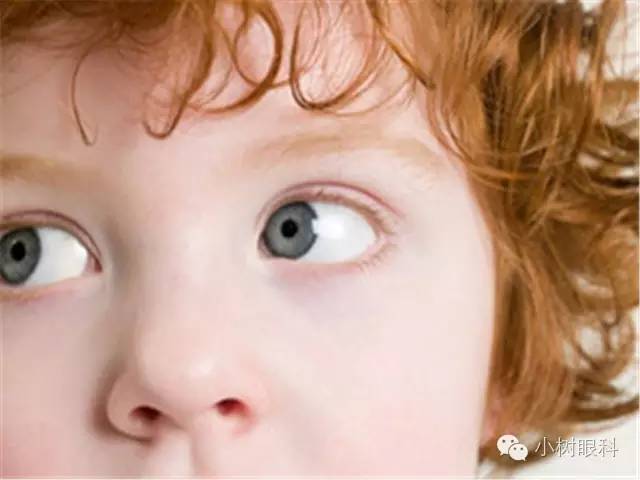 三個細節影響寶寶視力