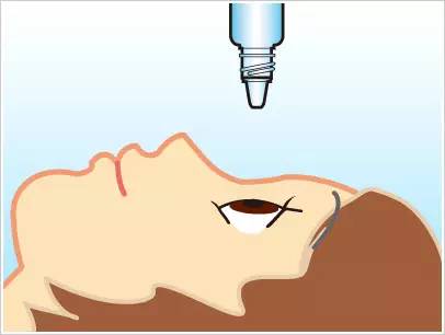 眼睛出現紅血絲怎么辦? 眼睛出現紅血絲怎么辦?