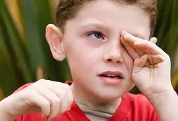 近視對眼睛有哪些傷害? 近視對眼睛有哪些傷害?