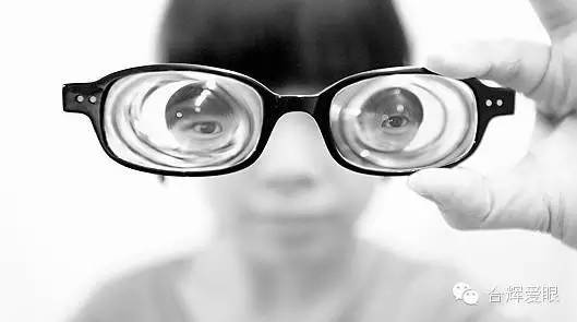 眼鏡戴久了,眼睛會(huì)變形嗎? 眼鏡戴久了,眼睛會(huì)變形嗎?