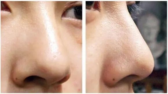 20個生活中的急救常識 20個生活中的急救常識