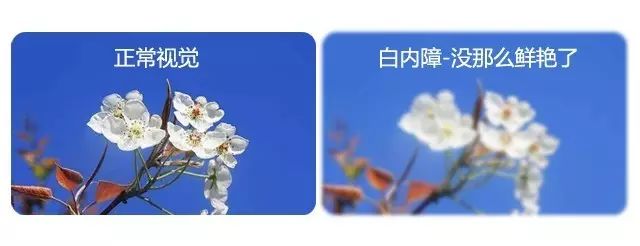 中老年人患白內障的真相是什么? 中老年人患白內障的真相是什么?